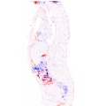 budelmann-deformable-registration.png