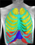 respiratory-motion.png