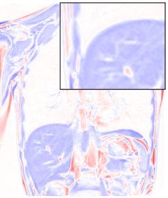 respiratory_motion.png